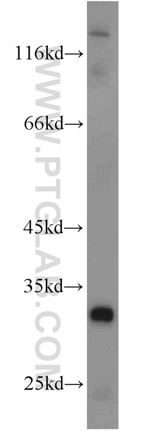 GNRHR Antibody in Western Blot (WB)