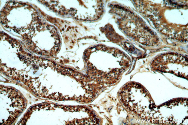 GNRHR Antibody in Immunohistochemistry (Paraffin) (IHC (P))