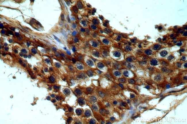 GNRHR Antibody in Immunohistochemistry (Paraffin) (IHC (P))