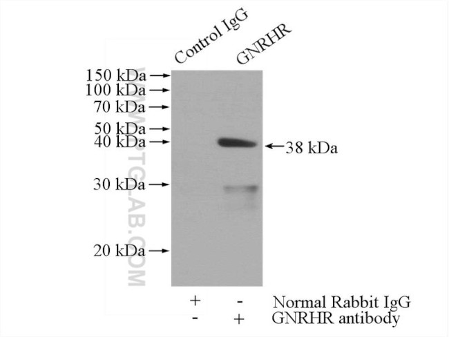 GNRHR Antibody in Immunoprecipitation (IP)