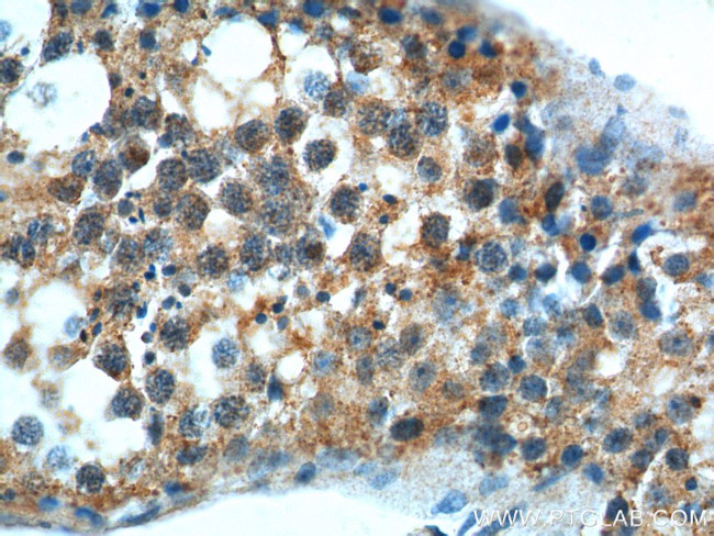 GPR22 Antibody in Immunohistochemistry (Paraffin) (IHC (P))