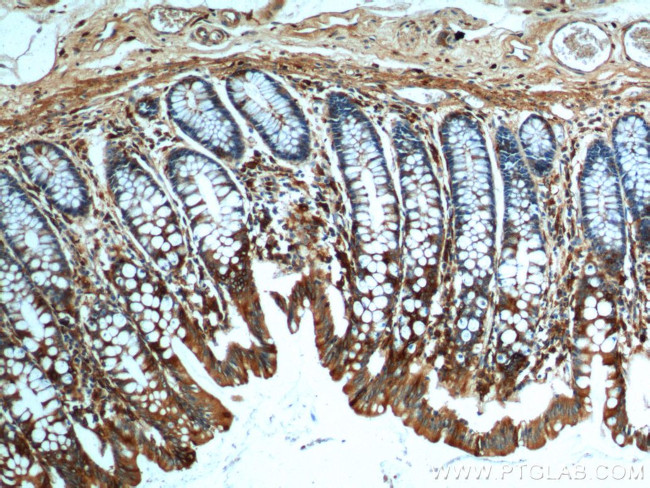 FFAR2 Antibody in Immunohistochemistry (Paraffin) (IHC (P))