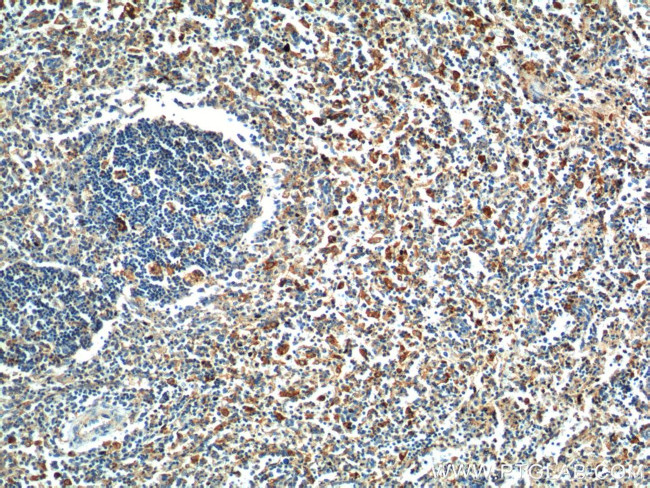 FFAR2 Antibody in Immunohistochemistry (Paraffin) (IHC (P))