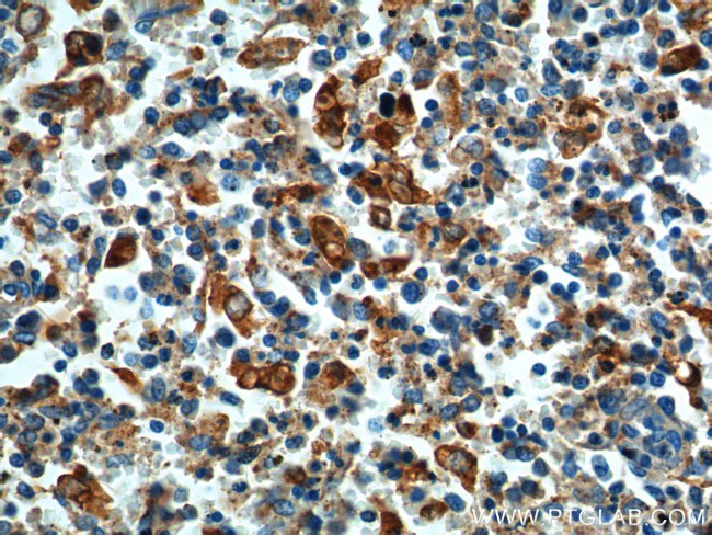 FFAR2 Antibody in Immunohistochemistry (Paraffin) (IHC (P))