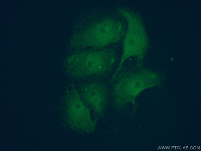 Huntingtin Antibody in Immunocytochemistry (ICC/IF)