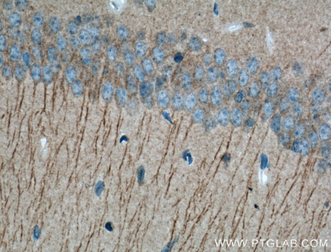 Huntingtin Antibody in Immunohistochemistry (Paraffin) (IHC (P))