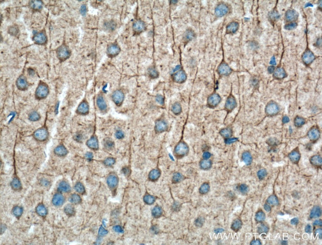 Huntingtin Antibody in Immunohistochemistry (Paraffin) (IHC (P))