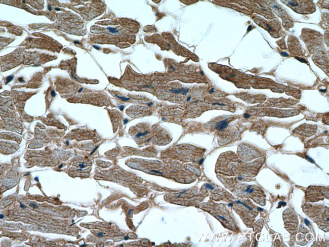 GAC Antibody in Immunohistochemistry (Paraffin) (IHC (P))