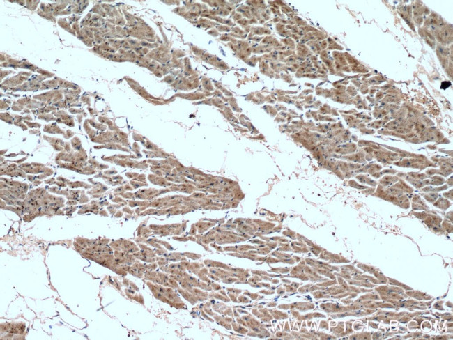 GAC Antibody in Immunohistochemistry (Paraffin) (IHC (P))