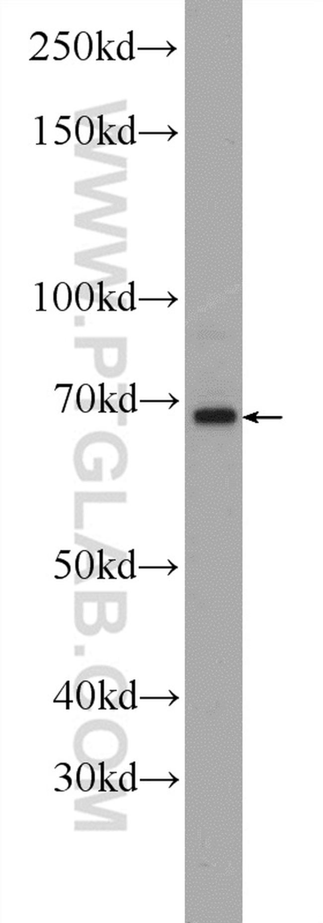 GAC Antibody in Western Blot (WB)