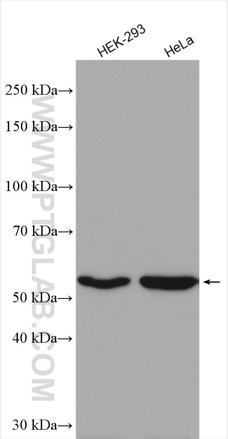 GAC Antibody in Western Blot (WB)