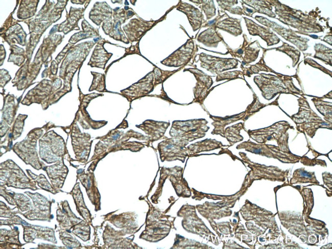 GAC Antibody in Immunohistochemistry (Paraffin) (IHC (P))