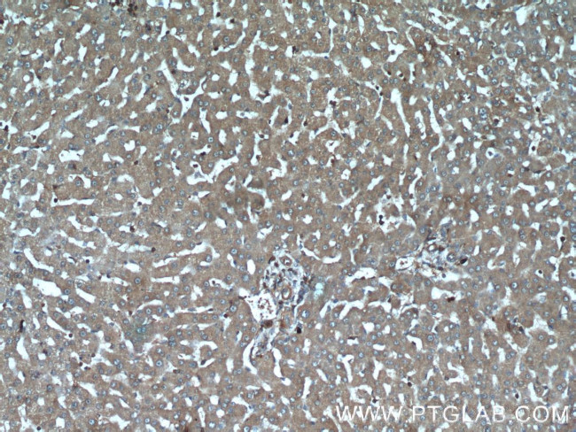 IGFBP7 Antibody in Immunohistochemistry (Paraffin) (IHC (P))