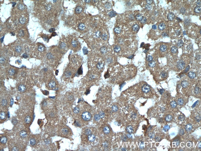 IGFBP7 Antibody in Immunohistochemistry (Paraffin) (IHC (P))