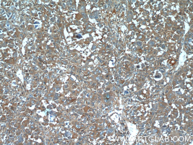 IGFBP7 Antibody in Immunohistochemistry (Paraffin) (IHC (P))