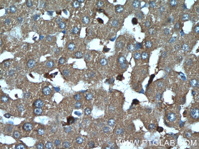 IGFBP7 Antibody in Immunohistochemistry (Paraffin) (IHC (P))