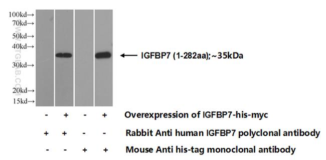 IGFBP7 Antibody in Western Blot (WB)