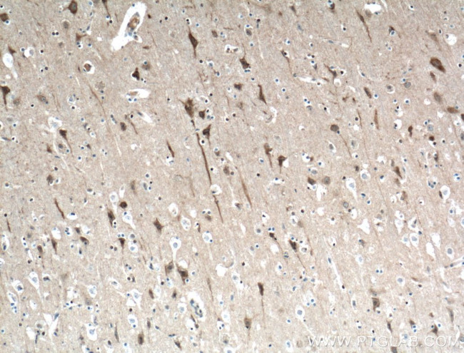 ITPR1 Antibody in Immunohistochemistry (Paraffin) (IHC (P))