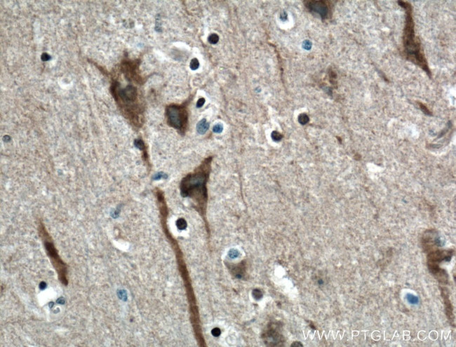 ITPR1 Antibody in Immunohistochemistry (Paraffin) (IHC (P))