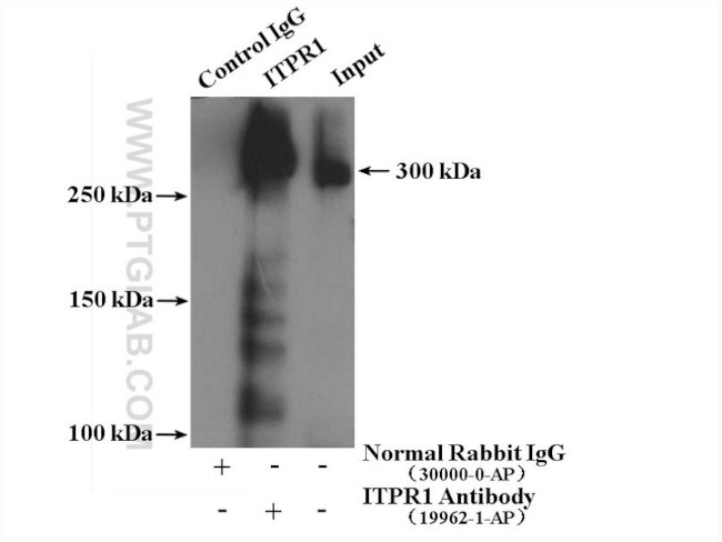 ITPR1 Antibody in Immunoprecipitation (IP)