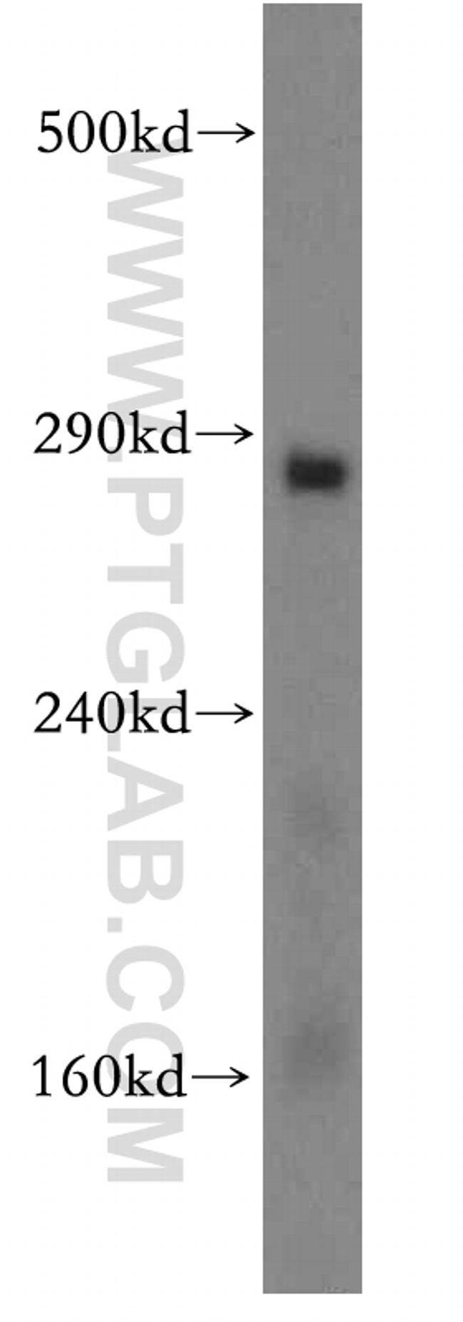 ITPR1 Antibody in Western Blot (WB)