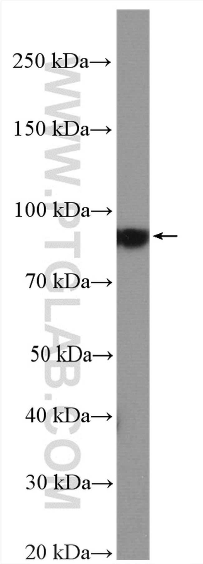 KCNQ3 Antibody in Western Blot (WB)