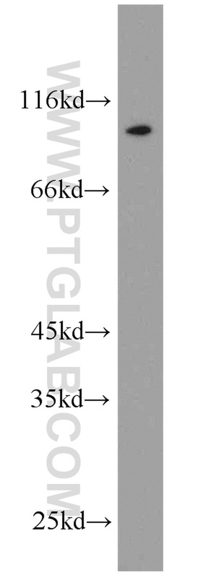 LHCGR Antibody in Western Blot (WB)