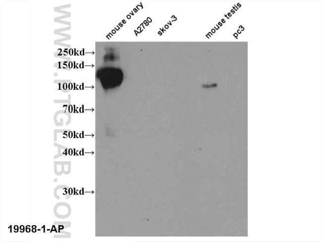 LHCGR Antibody in Western Blot (WB)