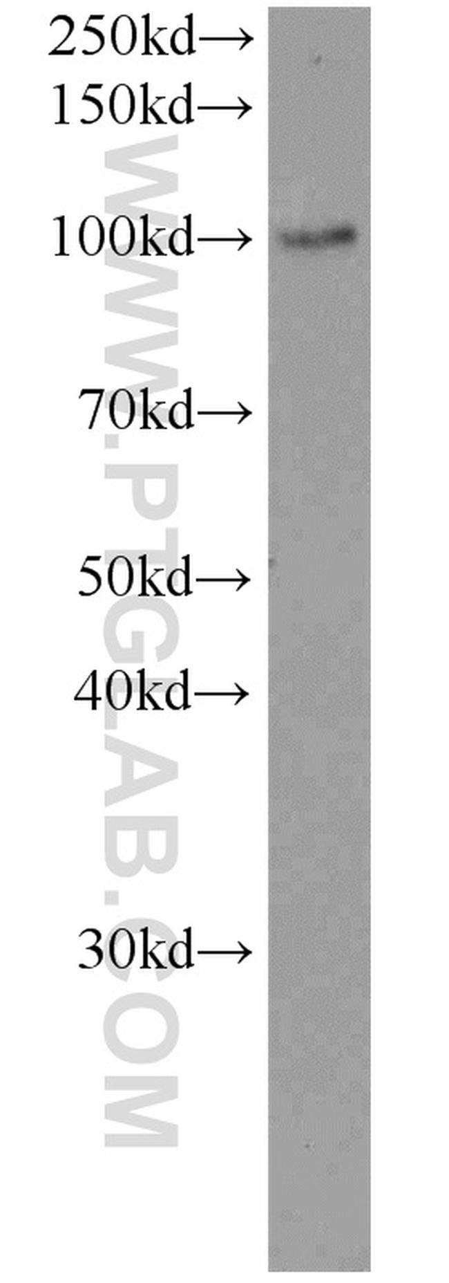 LHCGR Antibody in Western Blot (WB)