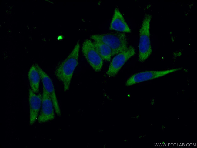 MAP3K1 Antibody in Immunocytochemistry (ICC/IF)