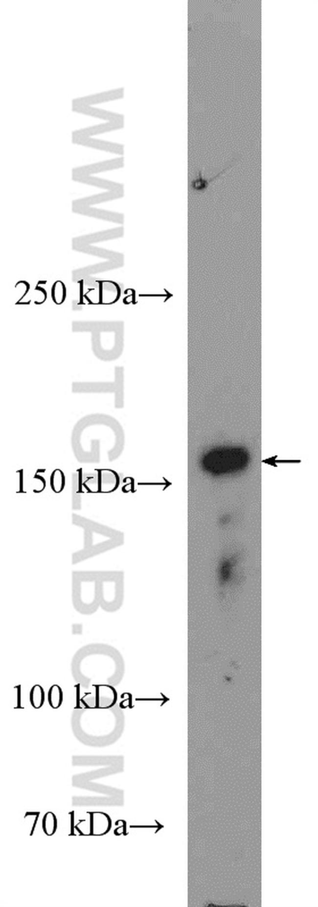 MAP3K1 Antibody in Western Blot (WB)