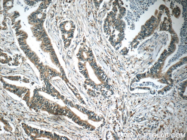 MLK2 Antibody in Immunohistochemistry (Paraffin) (IHC (P))