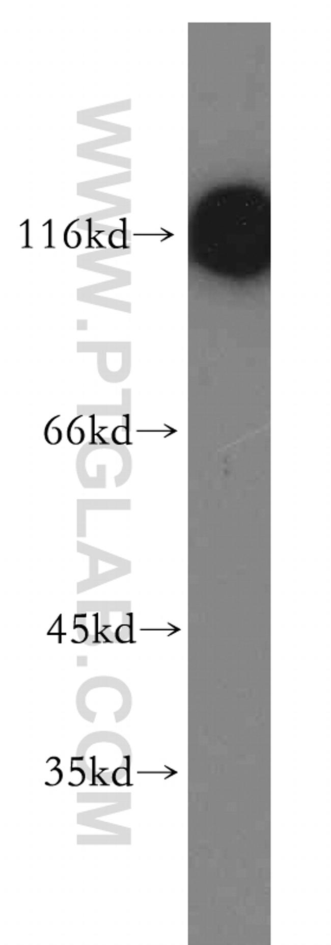 MLK2 Antibody in Western Blot (WB)