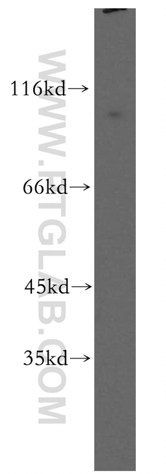 MLK2 Antibody in Western Blot (WB)