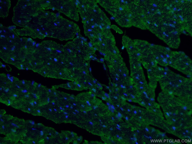 MYBPC3 Antibody in Immunohistochemistry (PFA fixed) (IHC (PFA))