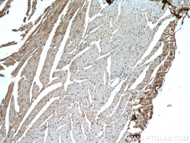 MYBPC3 Antibody in Immunohistochemistry (Paraffin) (IHC (P))