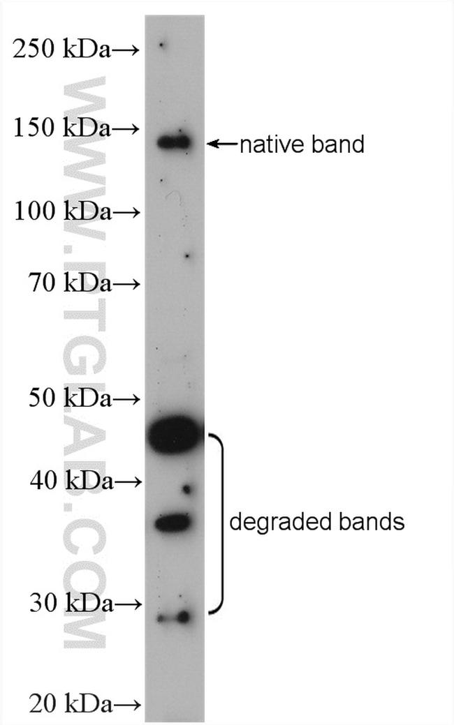 MYBPC3 Antibody in Western Blot (WB)