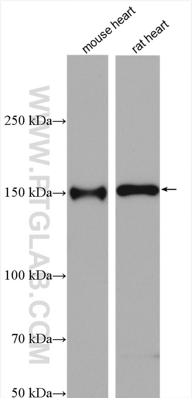 MYBPC3 Antibody in Western Blot (WB)