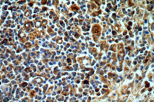 PAK2 Antibody in Immunohistochemistry (Paraffin) (IHC (P))