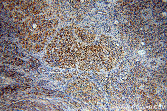 PAK2 Antibody in Immunohistochemistry (Paraffin) (IHC (P))