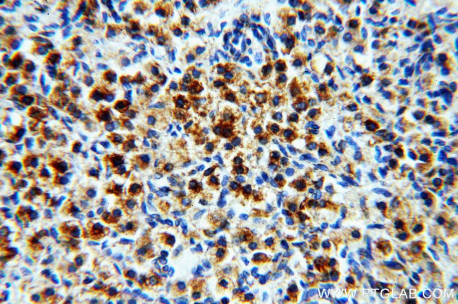 PAK2 Antibody in Immunohistochemistry (Paraffin) (IHC (P))