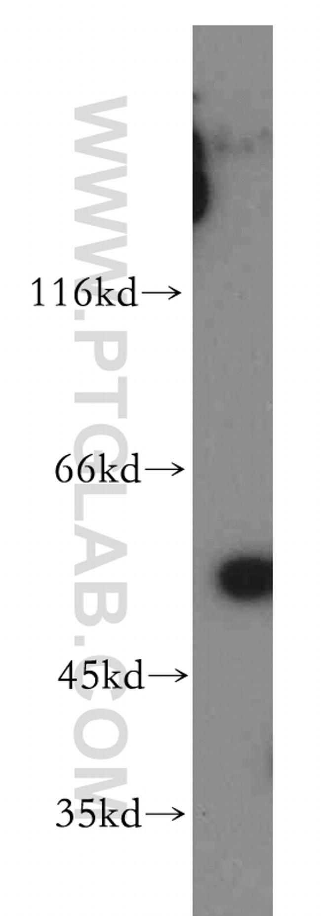 PAK2 Antibody in Western Blot (WB)