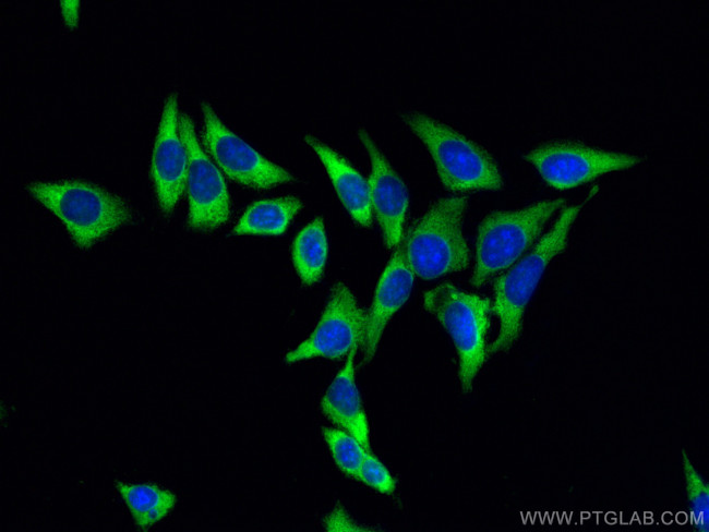 LDHA Antibody in Immunocytochemistry (ICC/IF)