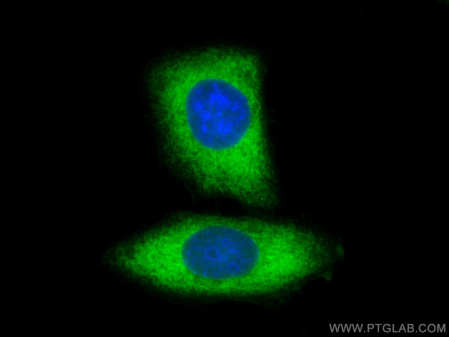 LDHA Antibody in Immunocytochemistry (ICC/IF)