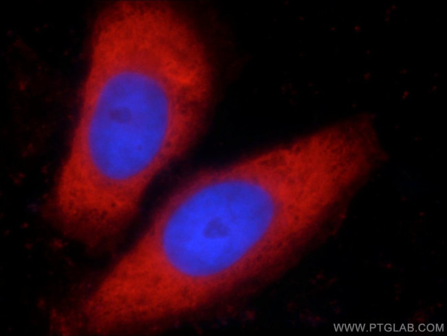 LDHA Antibody in Immunocytochemistry (ICC/IF)