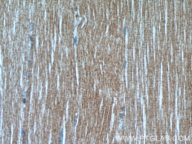 LDHA Antibody in Immunohistochemistry (Paraffin) (IHC (P))