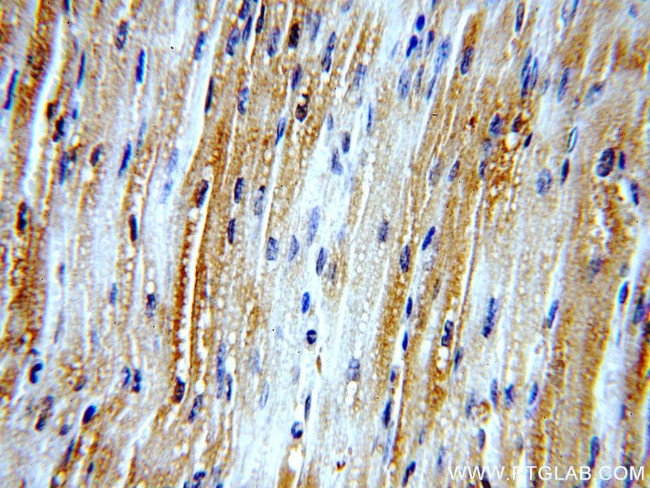 LDHA Antibody in Immunohistochemistry (Paraffin) (IHC (P))