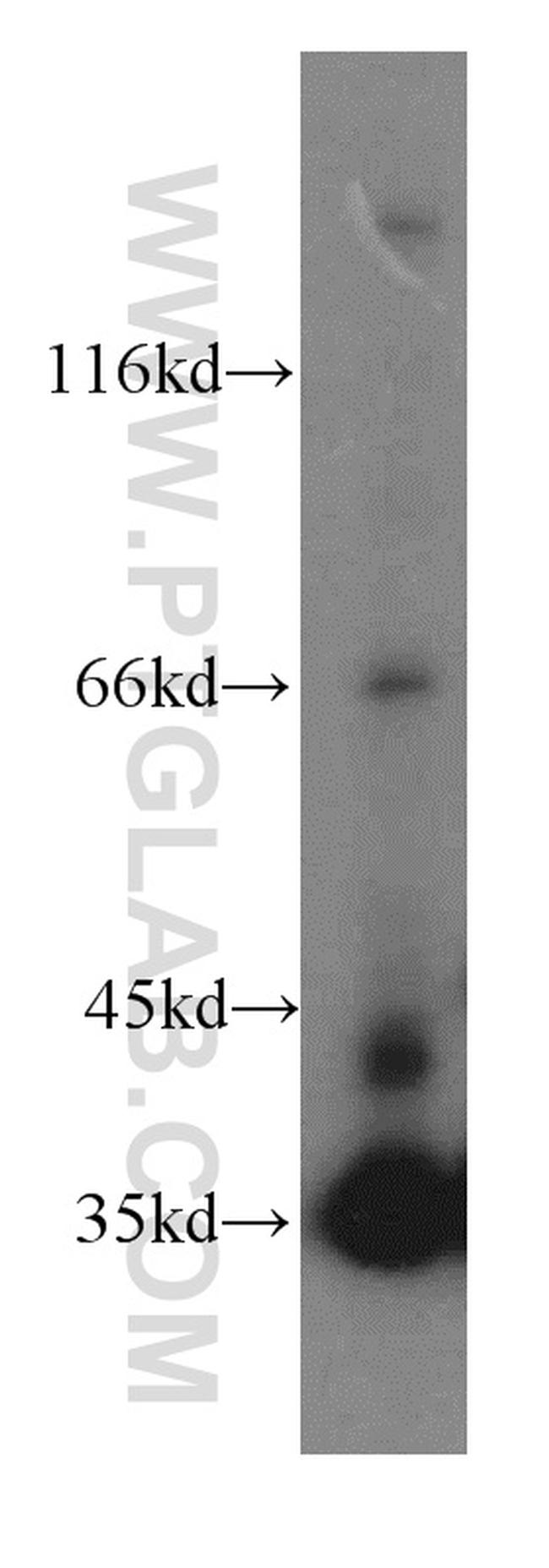 LDHA Antibody in Western Blot (WB)