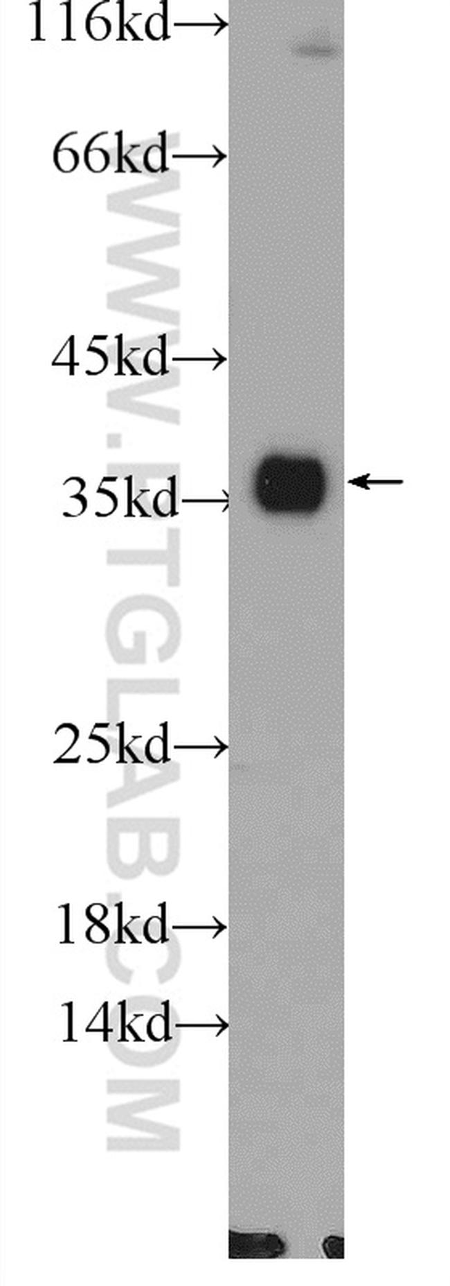 LDHA Antibody in Western Blot (WB)