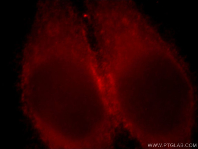 LDHC Antibody in Immunocytochemistry (ICC/IF)